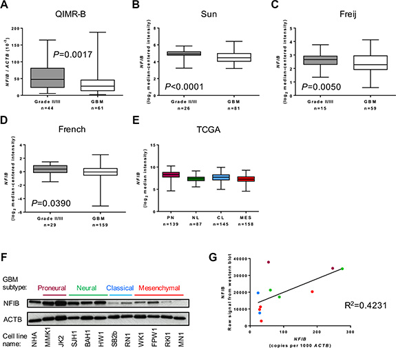 NFIB expression correlates inversely with astrocytoma grade.