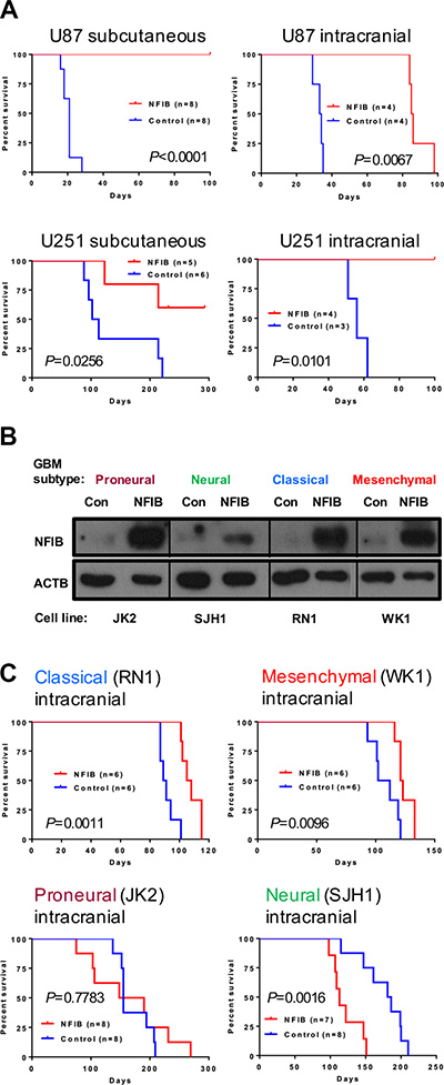 Ectopic expression of NFIB in human classical and mesenchymal GBM inhibits tumour growth.