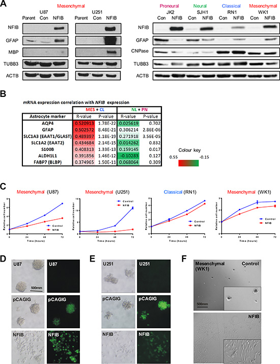 Ectopic expression of NFIB in human mesenchymal GBM induces differentiation, inhibits proliferation and inhibits self-renewal.