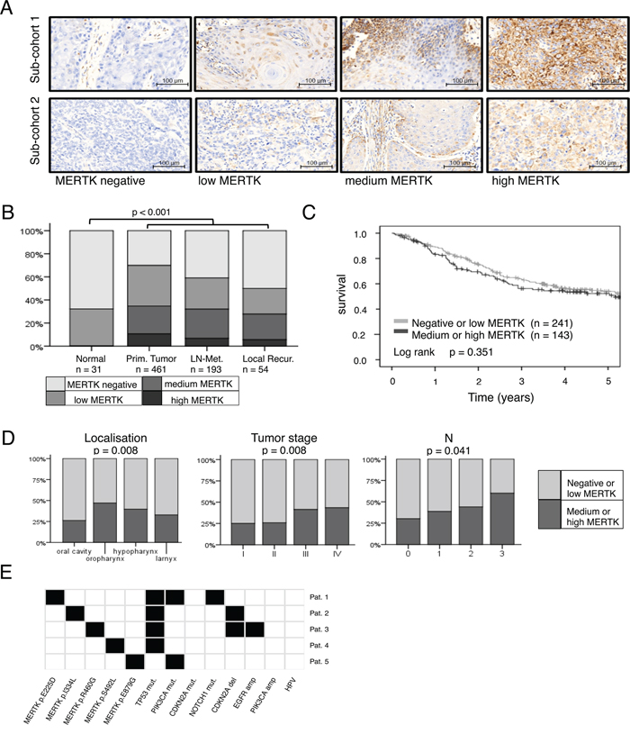 MERTK expression is increased in head and neck cancer.