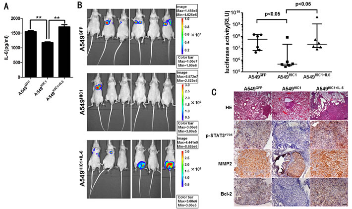 Effect of restoring HIC1 expression on tumor metastasis