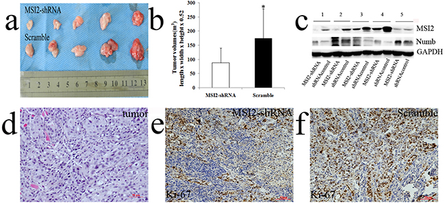 MSI2 silence inhibited subcutaneous tumors growth in vivo.