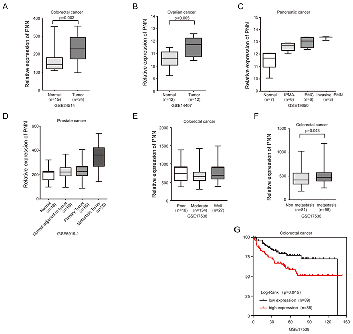 PNN overexpressed in tumors and is associated with the prognosis of CRC.