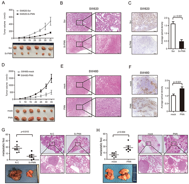 PNN is related to tumor growth and metastasis of CRC in vivo.