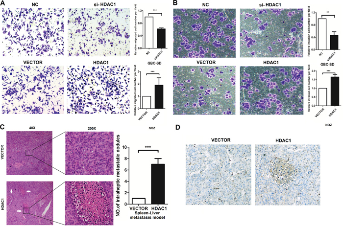 HDAC1 regulates cell invasion in GBC cancer cells.