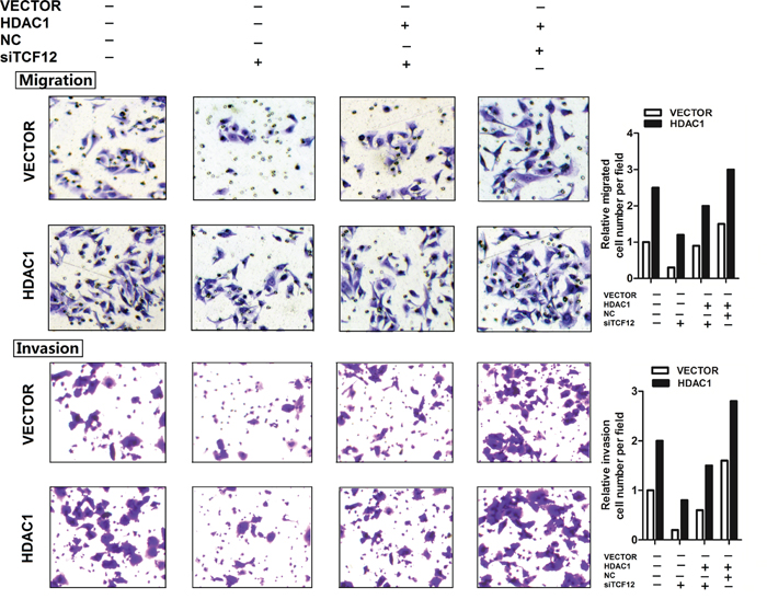 TCF-12 as an oncogene in GBC cell lines.