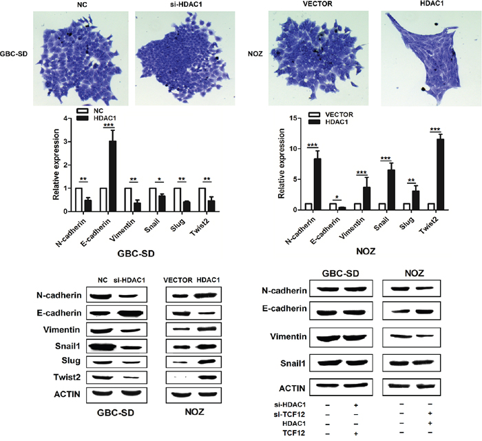 HDAC1 has promote EMT progress.