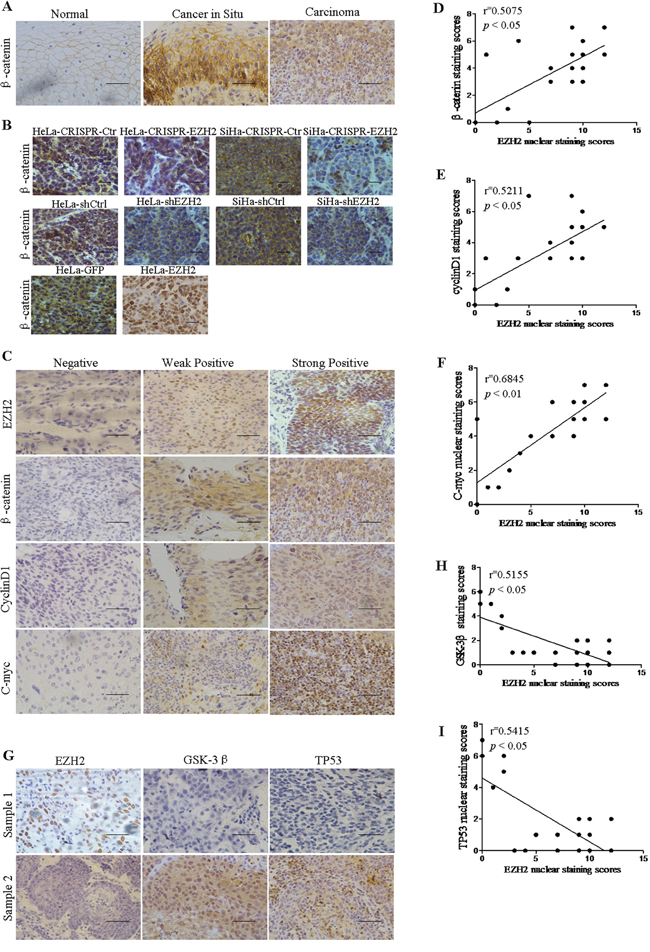 EZH2 expression is positively correlated with the expression of Wnt signaling-related proteins and negatively correlated with the expression of GSK-3&#x03B2; and TP53 in human cervical cancer tissues.