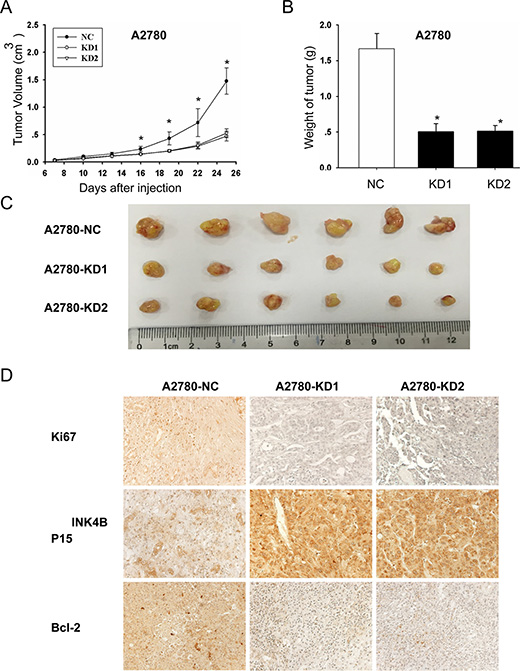 ANRIL knockdown inhibits A2780 cell proliferation in vivo.