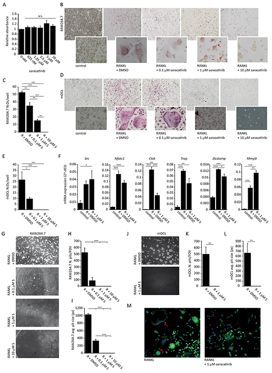 Effect of saracatinib on osteoclast differentiation and function.