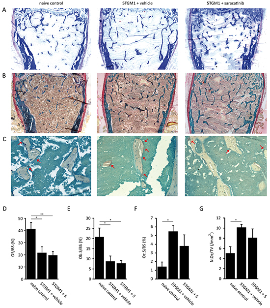 Histomorphometric analysis of bone parameters in the 5TGM.1 multiple myeloma model.