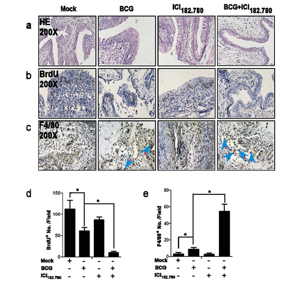 ICI 182,780 (ICI) potentiates the anti-tumor effects of BCG in the BBN-induced mouse BCa model.