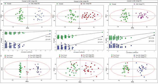 PR analysis of 1H-NMR fecal spectra between different stages of CRC and healthy control.