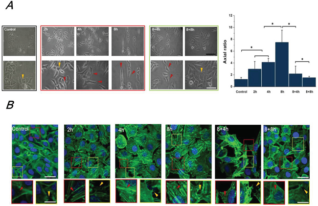 FSS induced the morphology and F-actin changes of Hep2 cells.