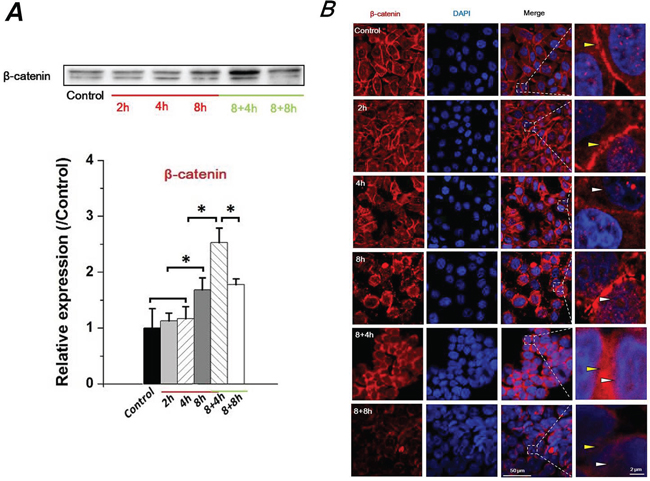 FSS induced expression level change and translocation of &#x03B2;-catenin in Hep-2 cells.