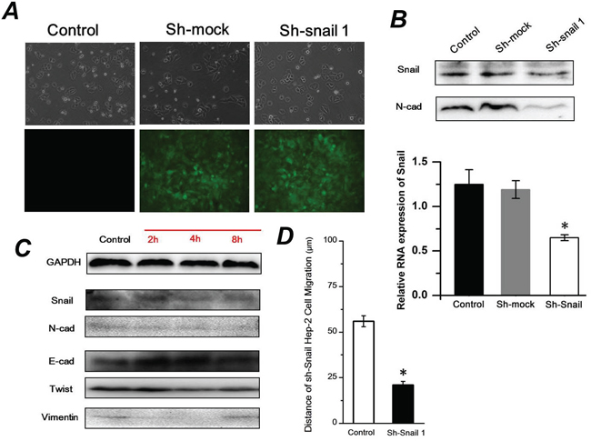 Sh-Snail1 inhibits the FSS-induced EMT in Hep-2 cells.
