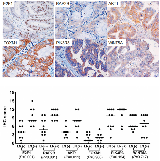 Immunohistochemical staining for E2F1, RAP2B, FOXM1, PIK3R3, AKT1, and WINT5A.