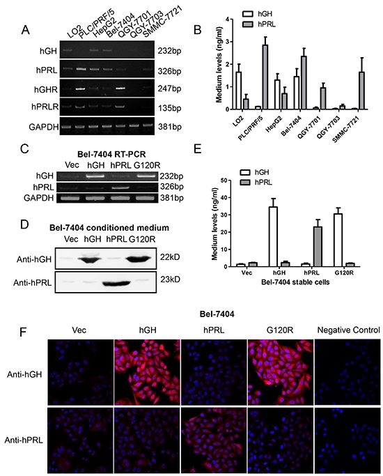 Forced expression of hGH, hPRL and G120R in Bel-7404 cells.