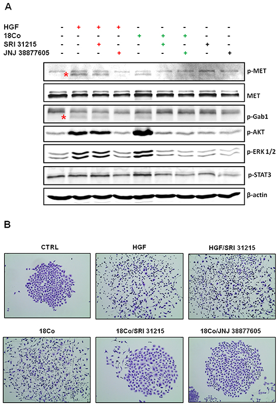 SRI 31215 inhibits the crosstalk between tumor cells and fibroblasts.
