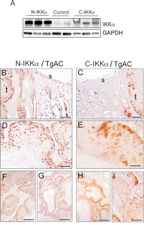 Analysis of the expression of the transgene in C-IKK&#x03B1; and N-IKK&#x03B1; tumors by biochemical and immunohistochemical approaches.