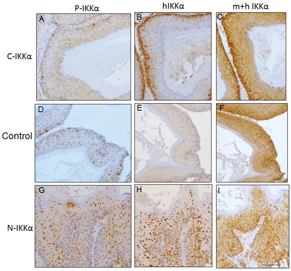 Analysis of phosphorylated P-IKK&#x03B1;, and human and mouse IKK&#x03B1; in tumors of the three groups.