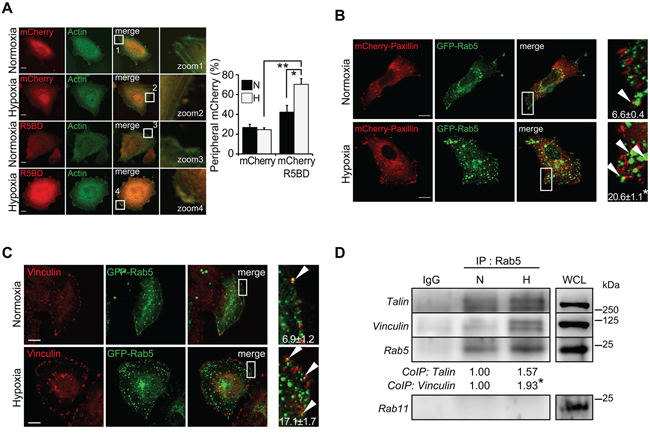 Hypoxia increases the association of Rab5 with focal adhesion proteins.