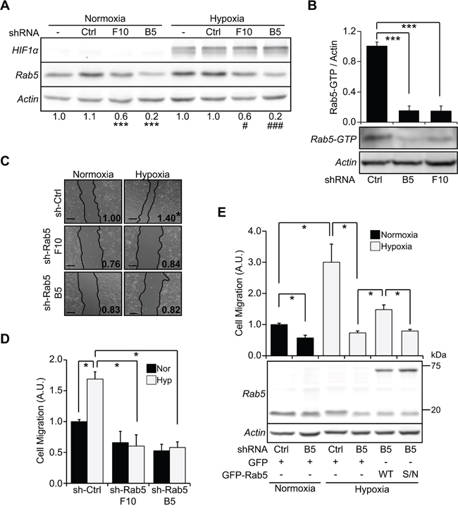 Rab5 activation is required for hypoxia-induced cell migration.