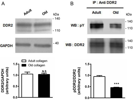 Effect of collagen aging on DDR2 expression and activation.