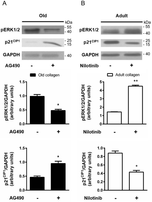 Effect of DDR2 and JAK2 inhibition on ERK1/2 activation and p21