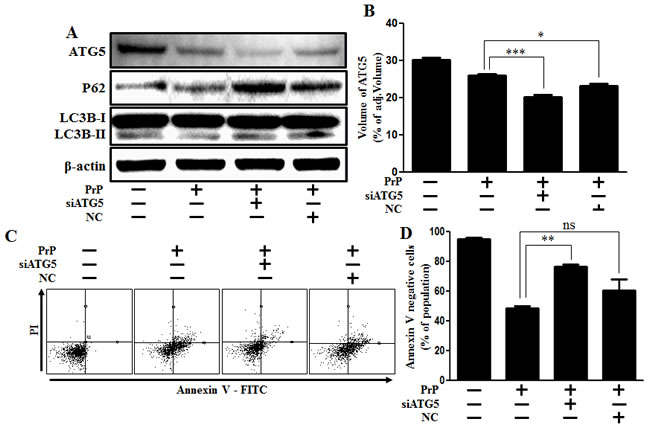 Inhibition of ATG5 gene expression alleviated PrP (106-126)-induced cytotoxicity.