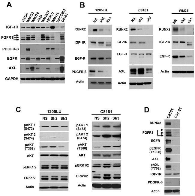 RUNX2 knock down results in reduced expression of RTKs.