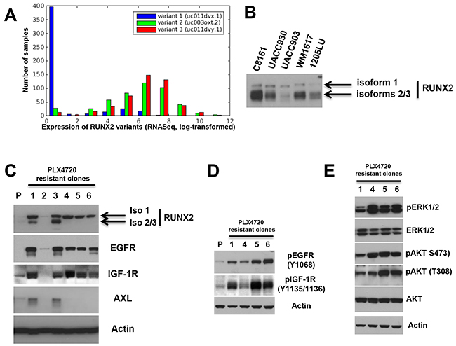 Increased expression of RUNX2 isoforms and RTKs in melanoma cells resistant to BRAF V600E inhibition.