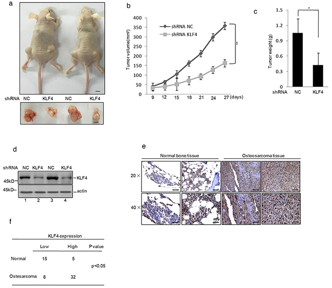 Figure 2. KLF4 promoted human osteosarcoma cells tumorigenicity in a nude mice model.