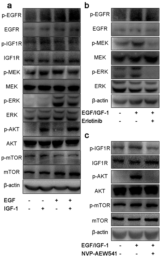 Effect of single inhibitor on EGFR and IGF1R downstream signaling pathways in SW13 cells.