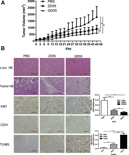GD55 inhibited PLC/PRF/5 sphere xenograft tumors growth in nude mice.