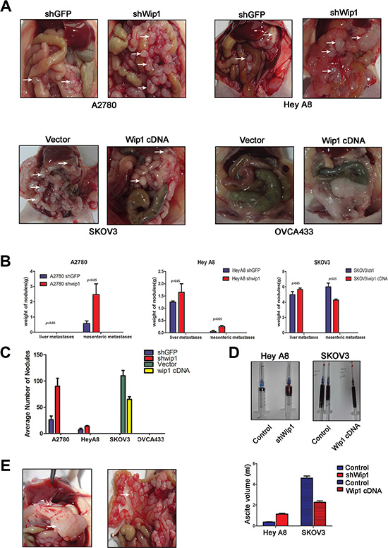 Wip1 suppresses tumor metastasis in vivo.