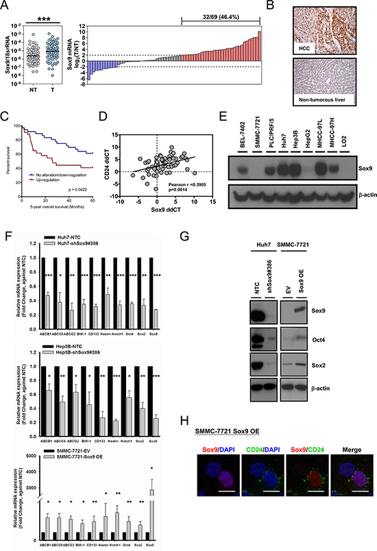 Sox9 is upregulated in human HCC and Sox9 expression is associated with expression of stemness markers in vitro.