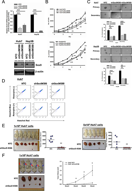 Silencing of Sox9 inhibits cell proliferation, tumorsphere formation and in vivo tumorigenicity in HCC.