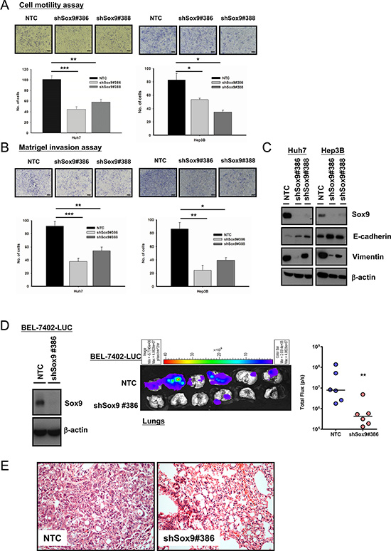 Silencing of Sox9 inhibits cell migration, invasion in vitro and metastasis of HCC in vivo.