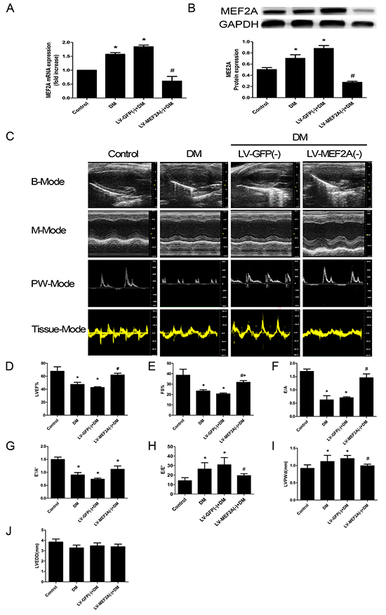 MEF2A expression and Echocardiography measurements of mouse hearts.