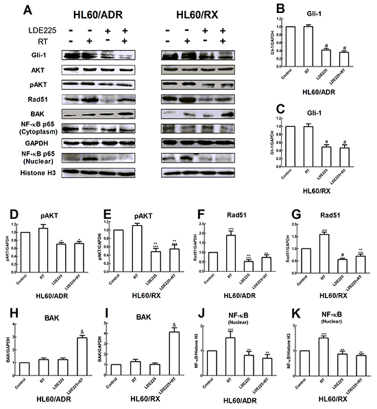 LDE225 enhances the radiosensitivity by downregulating the activation of pAKT and NF-kB in HL60/ADR and HL60/RX cells.