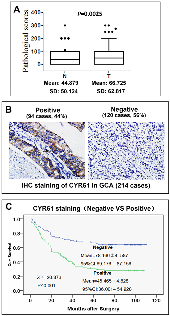 CYR61 is overexpressed in GCA and the overexpression is inversely correlated with cumulative survival of GCA patients.