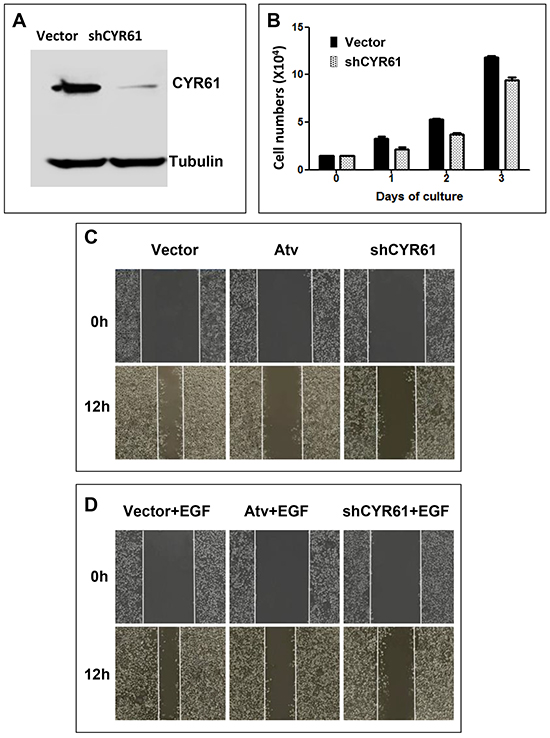 CYR61 is essential for cell migration and required for EGF-promoted migration and invasion in gastric cancer AGS cells.