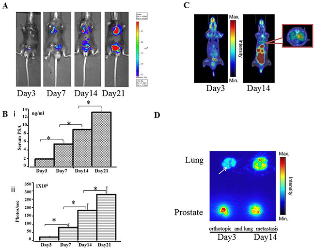 Preclinical orthotopic and lung metastasis mouse models using RM9-Luc-pIRES-KLK3 cells (n = 7)