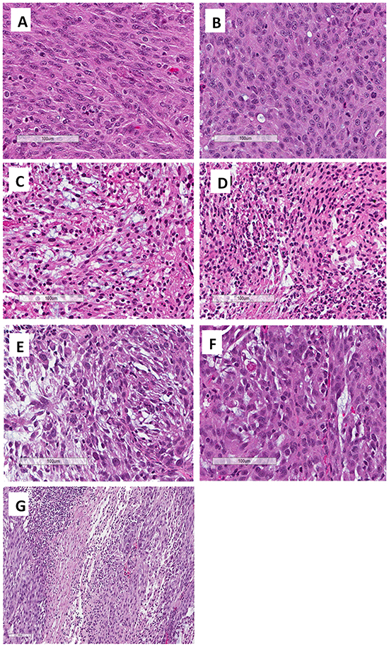 Photomicrographs of H&#x0026;E-stained slides from the original patient tumor and the PDOX-grown tumor.