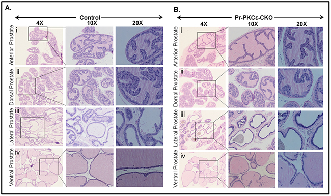 Histopathological analysis of PKC&#x03B5;LoxP/LoxP/PBCre4/- (Control) and PKC&#x03B5;LoxP/LoxP/PBCre4/&#x002B; (Pr-PKC&#x03B5;-CKO) mice.