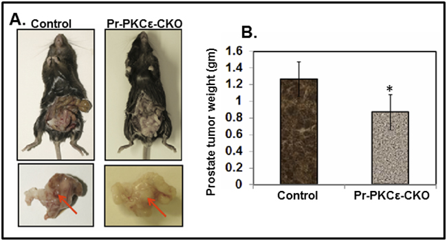 Inhibition of TRAMPC1 cells orthotopic xenograft tumors in prostate specific PKC&#x03B5; knockout (Pr-PKC&#x03B5;-CKO) mice.