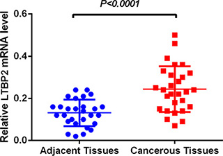 LTBP2 mRNA level was significantly higher in HNSCC tissues than in adjacent normal tissues.