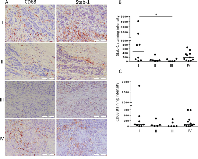 Stabilin-1 expression in human breast cancer.