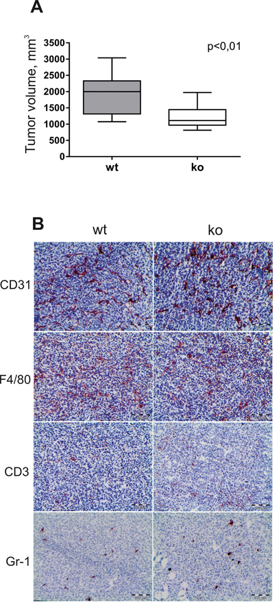 The effect of stabilin-1 on tumor growth and infiltration of TS/A tumors by immune cells.